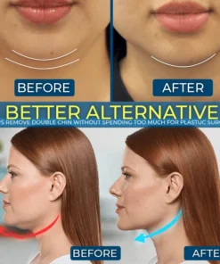 V-Lab definitore della linea mascellare