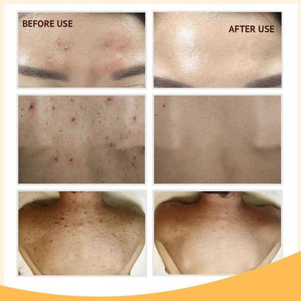 Set di sieri illuminanti al retinolo C+ - Image 10