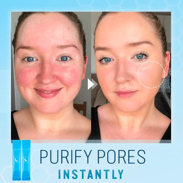 Maschera cremosa rinfrescante per la pelle - Image 2