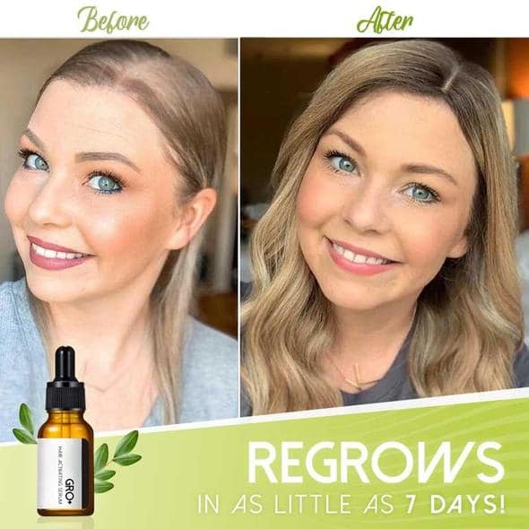 Siero attivante per capelli Gro+ - Image 3