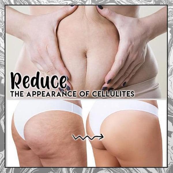 Saponetta per la rimozione della cellulite alla cenere vulcanica al caffè - Image 3