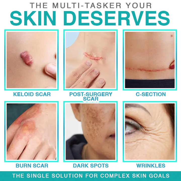 ๐๐ฎ๐ฟ๐ฒ๐๐ฟ๐ฒ๐ฒ๐๐ฒยฎ Patch per la cura dei microaghi 3 in 1 - Image 2