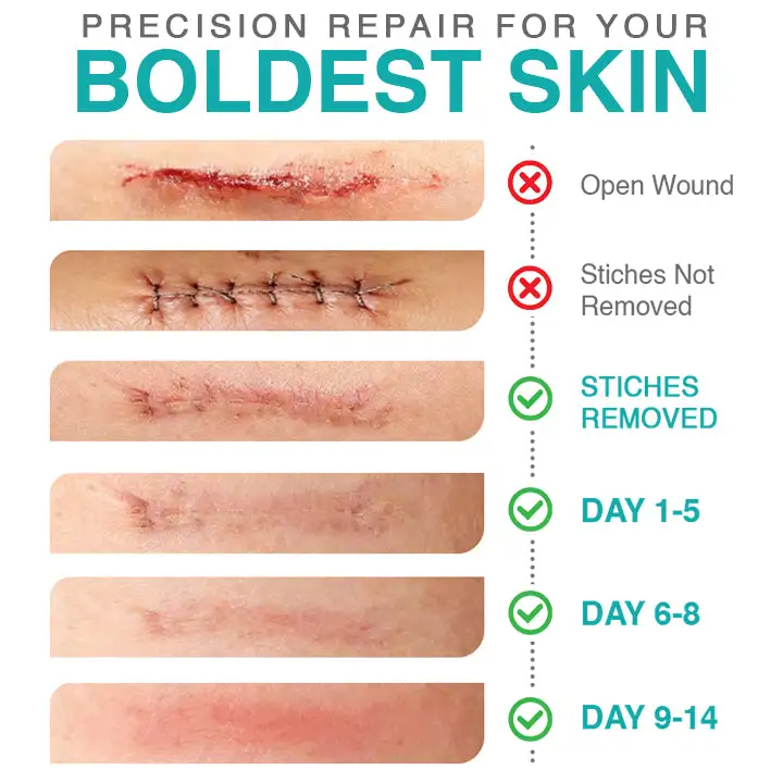 ๐๐ฎ๐ฟ๐ฒ๐๐ฟ๐ฒ๐ฒ๐๐ฒยฎ Patch per la cura dei microaghi 3 in 1 - Image 4