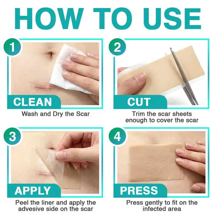 ๐๐ฎ๐ฟ๐ฒ๐๐ฟ๐ฒ๐ฒ๐๐ฒยฎ Patch per la cura dei microaghi 3 in 1 - Image 7