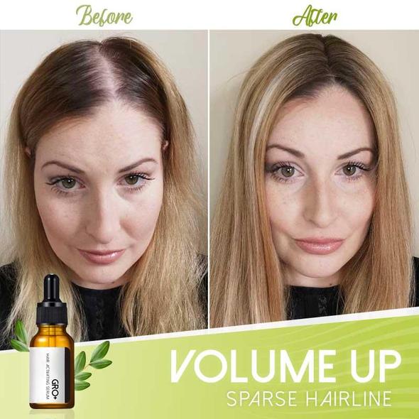 Siero attivante per capelli Gro+ - Image 4