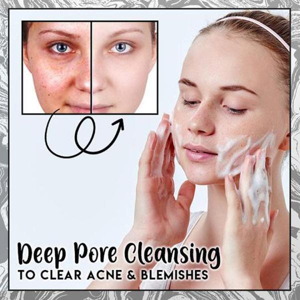 Saponetta per la rimozione della cellulite alla cenere vulcanica al caffè - Image 5