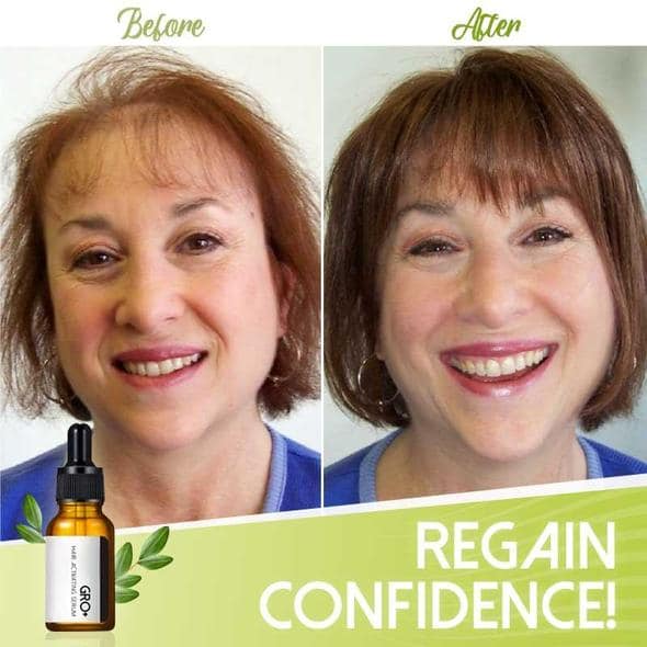 Siero attivante per capelli Gro+ - Image 6