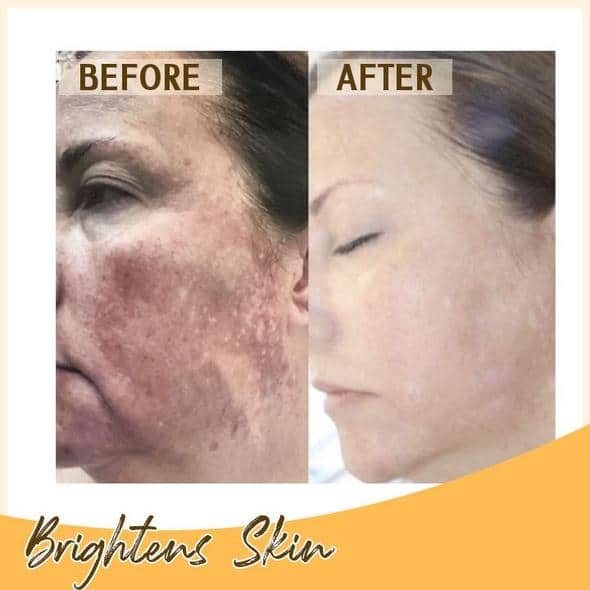 Set di sieri illuminanti al retinolo C+ - Image 6