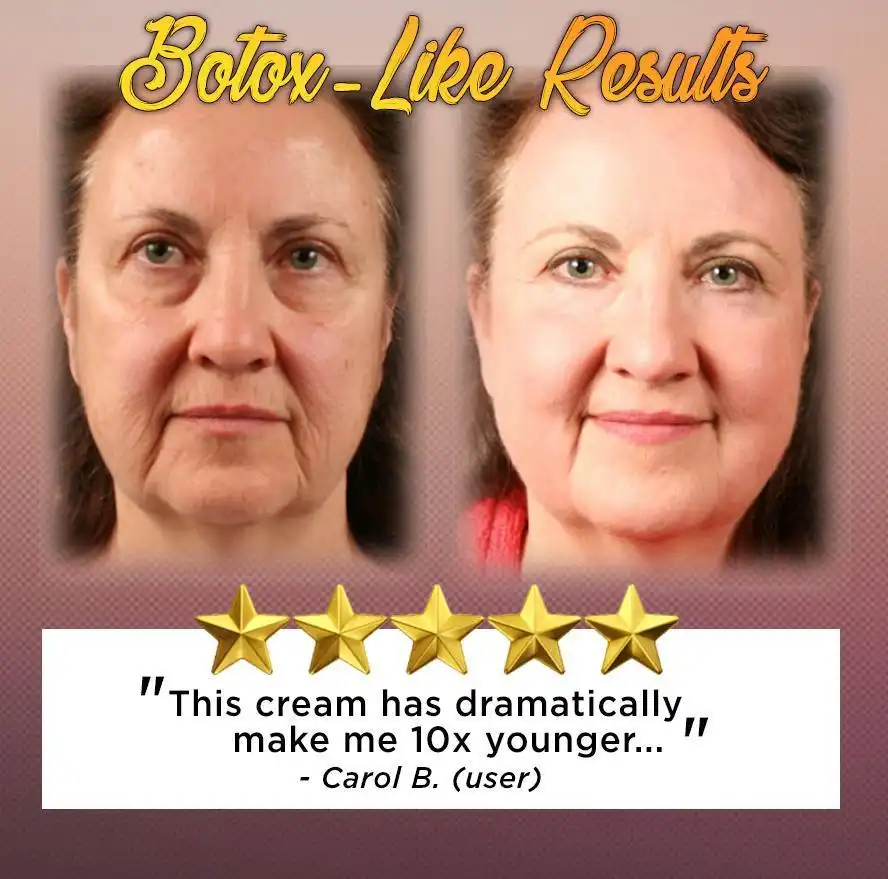 Crema viso e corpo al veleno di serpente - Image 2