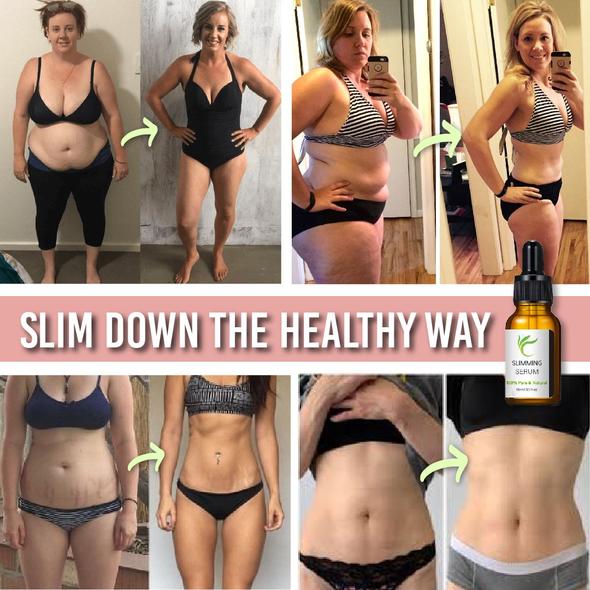 Cintura per addominoplastica con siero brucia grassi - Image 6