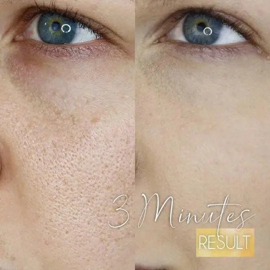 Siero Dr. W Zero Pore - Image 7