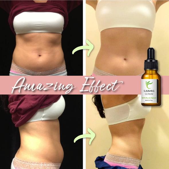 Cintura per addominoplastica con siero brucia grassi - Image 7