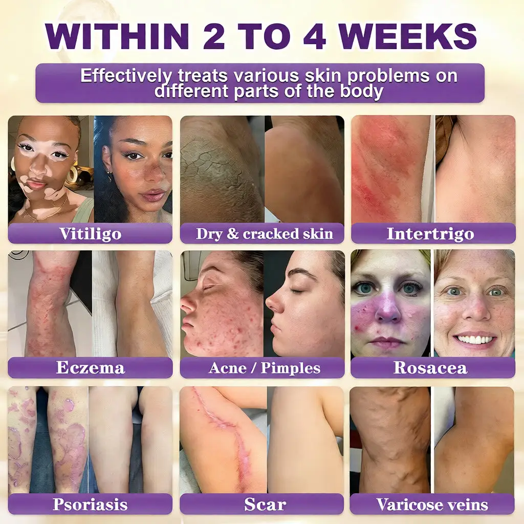 Crema rigenerante per la pelle 10 in 1 alla biotina Acezozla® - Image 2