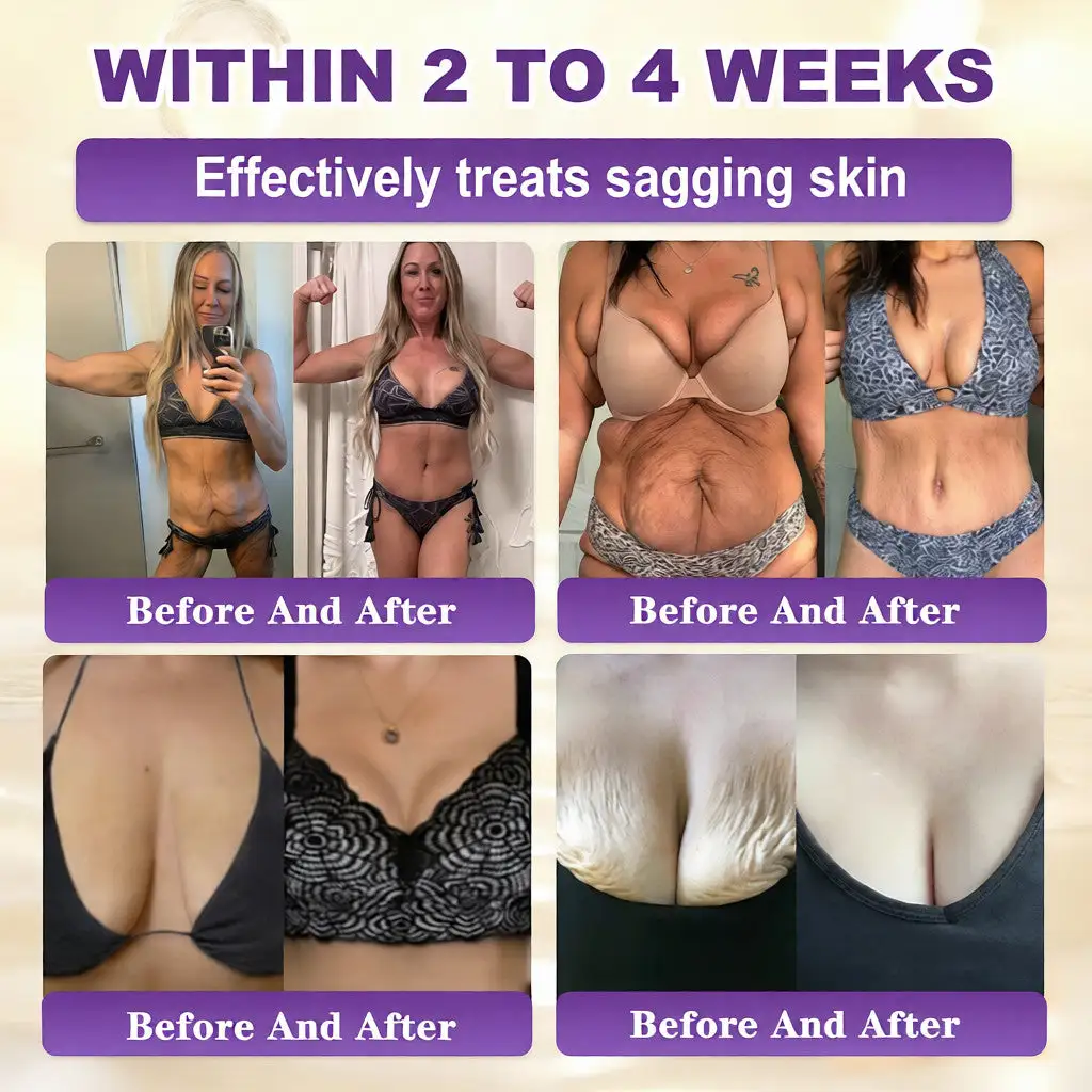 Crema rigenerante per la pelle 10 in 1 alla biotina Acezozla® - Image 3