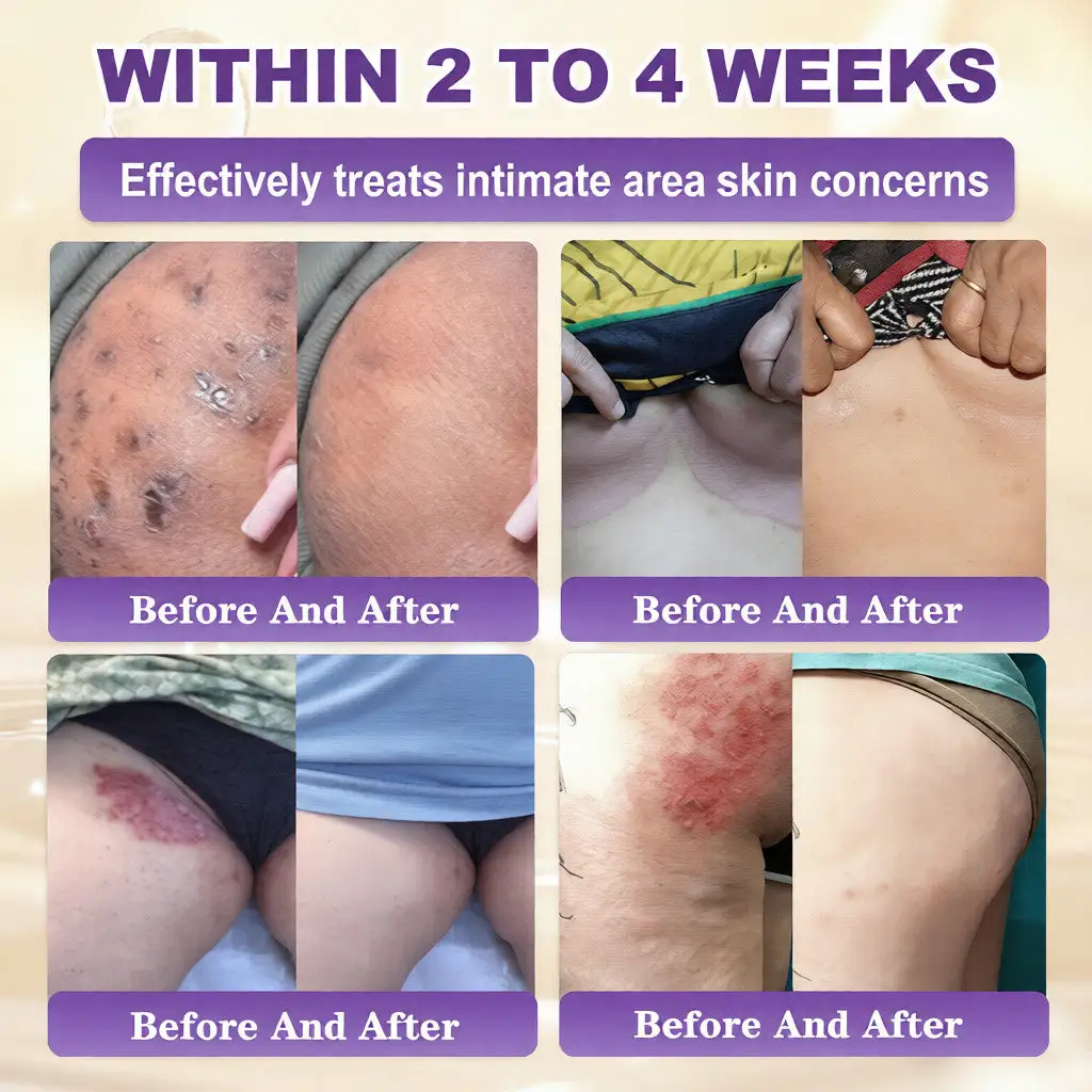 Crema rigenerante per la pelle 10 in 1 alla biotina Acezozla® - Image 4