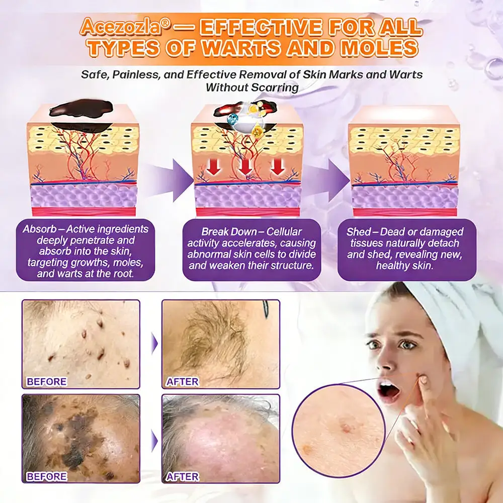 Crema rigenerante per la pelle 10 in 1 alla biotina Acezozla® - Image 9