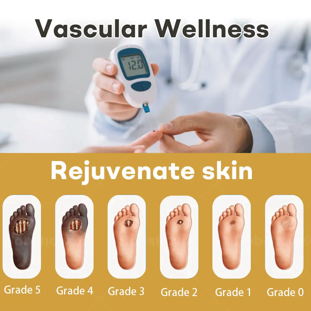 Acezozla® GlucoShield Spray al veleno d'api per ferite - Image 2