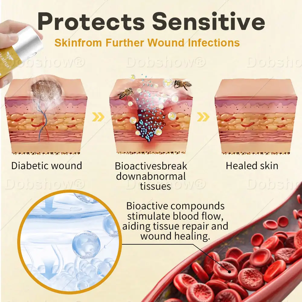 Acezozla® GlucoShield Spray al veleno d'api per ferite - Image 3