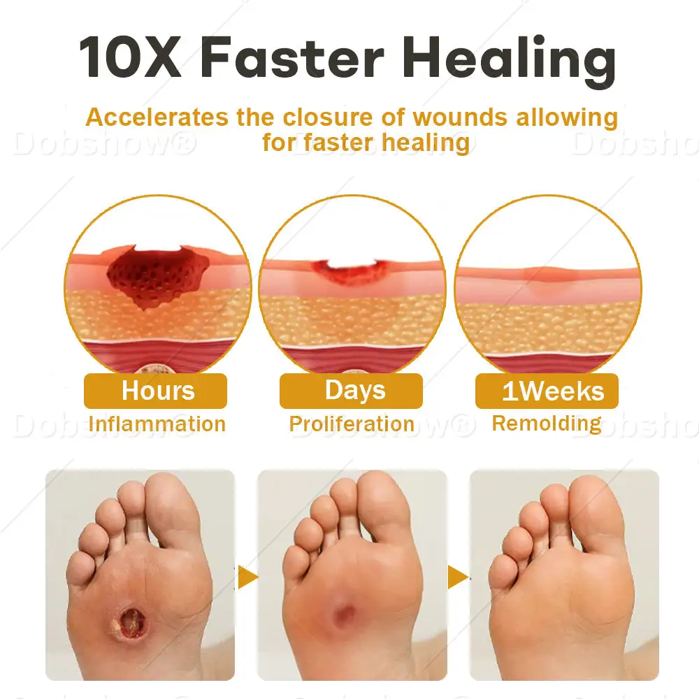 Acezozla® GlucoShield Spray al veleno d'api per ferite - Image 4