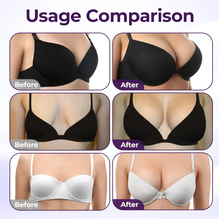 Acezozla® Maxcurve Crema Liftante e Rimpolpante - Image 15