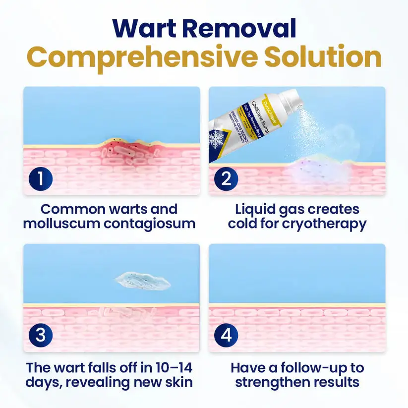 DermChiller® ChillErase Spray per il rinnovamento di protuberanze ed etichette cutanee - Image 4