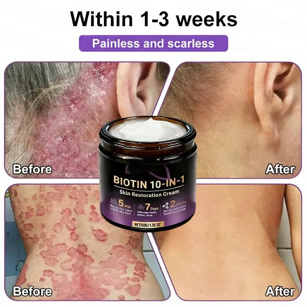 Crema rigenerante per la pelle VORLORA® Biotina 10 in 1 - Image 5