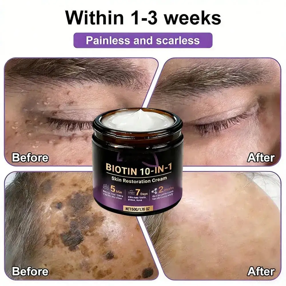 Crema rigenerante per la pelle VORLORA® Biotina 10 in 1 - Image 7