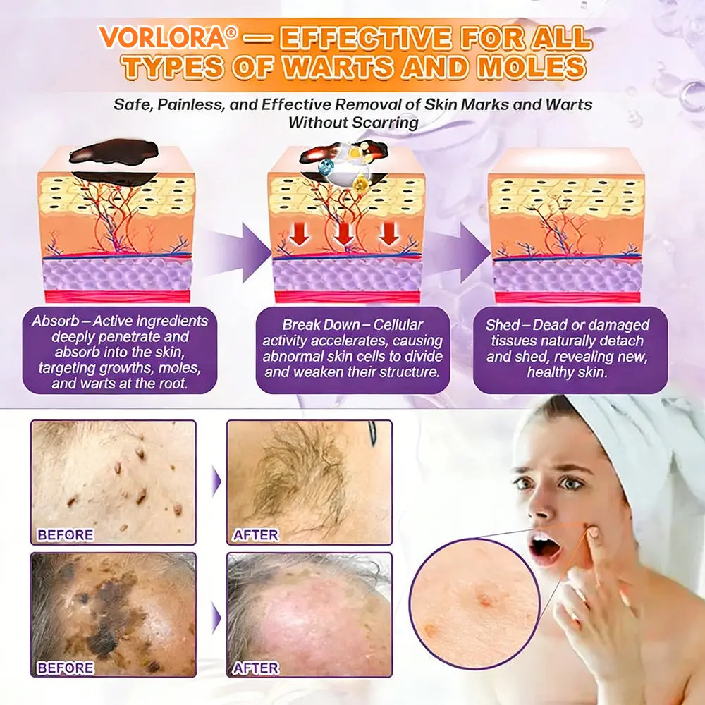 Crema rigenerante per la pelle VORLORA® Biotina 10 in 1 - Image 9