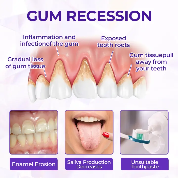 Dentifricio al fluoro Virexo™ SensiGum - Image 8