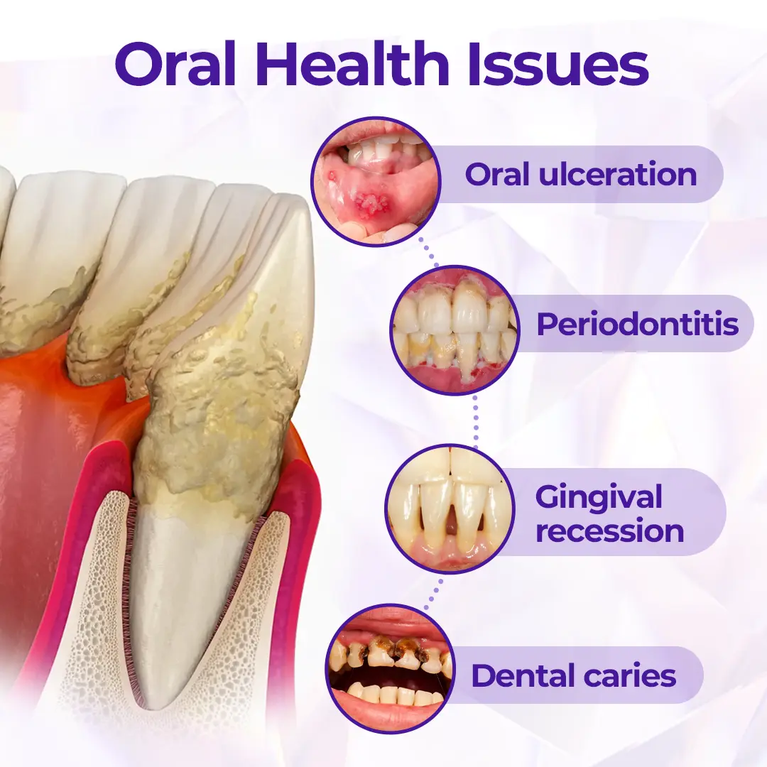 Dentifricio al fluoro Virexo™ SensiGum - Image 9