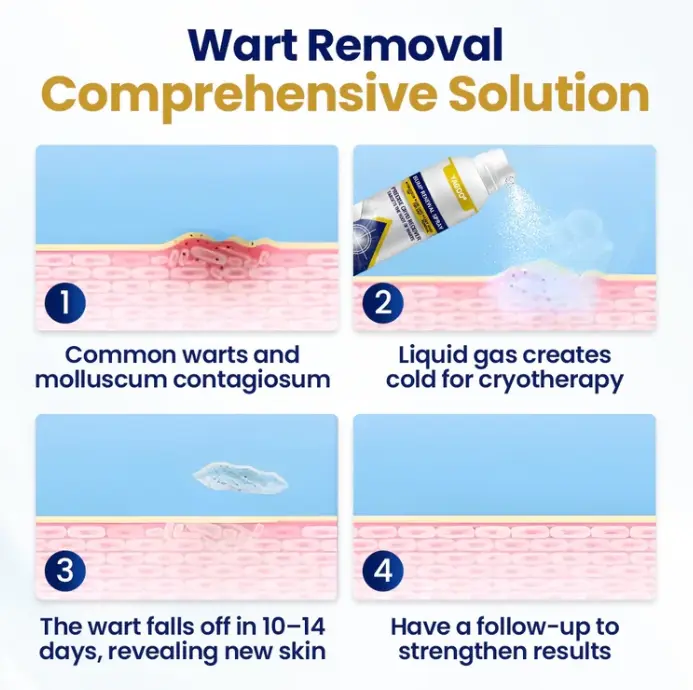 Yagoo® Chillique Spray rinnovante per le protuberanze - Image 3