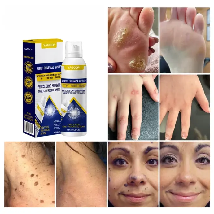 Yagoo® Chillique Spray rinnovante per le protuberanze - Image 5